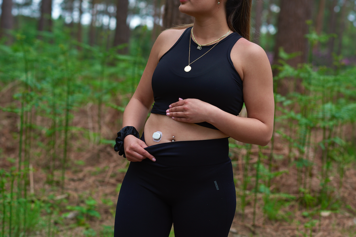 A person wearing a CGM. 